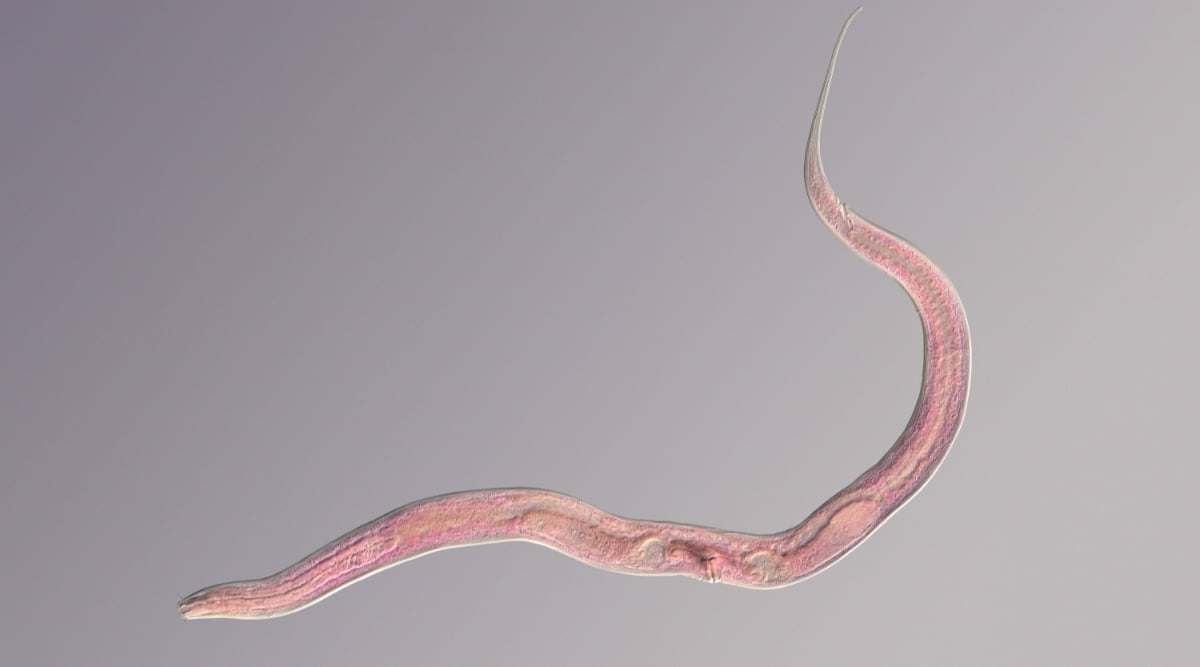 Microscopic photograph of a nematode colored under a phase contrast microscope. The nematode is a microscopic, unsegmented roundworm with an elongated, cylindrical body tapered at both ends. It has a pinkish tint.