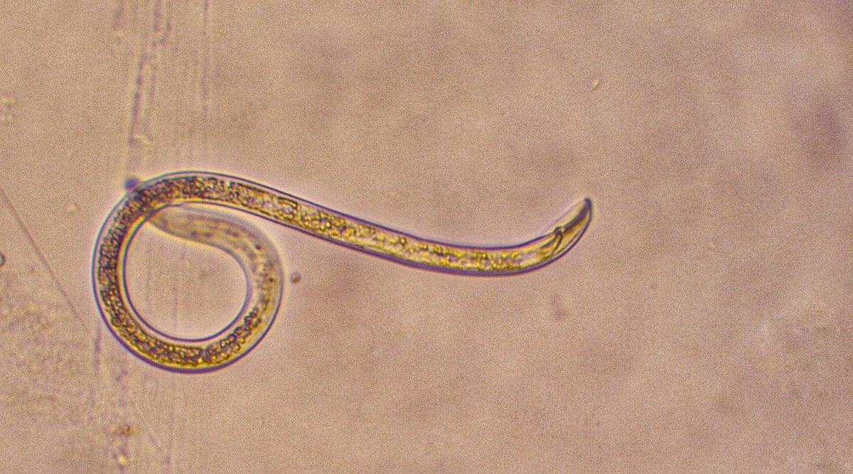 Close-up of a Nematode under a microscope against a brownish-pinkish background. Nematodes are slender, unsegmented roundworms with a simple, tube-like body structure. It is translucent.